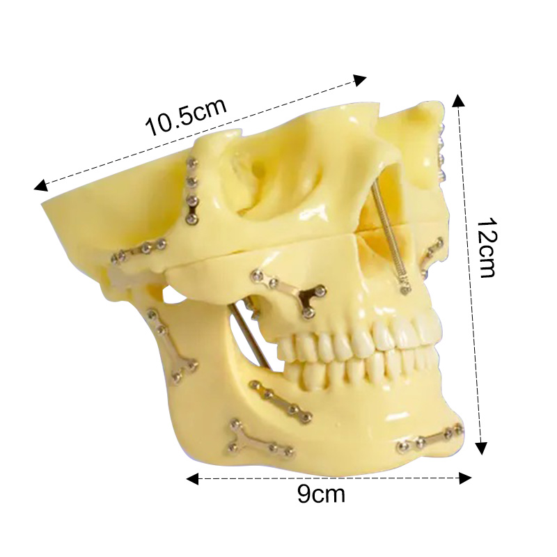 dental surgery microscope  03