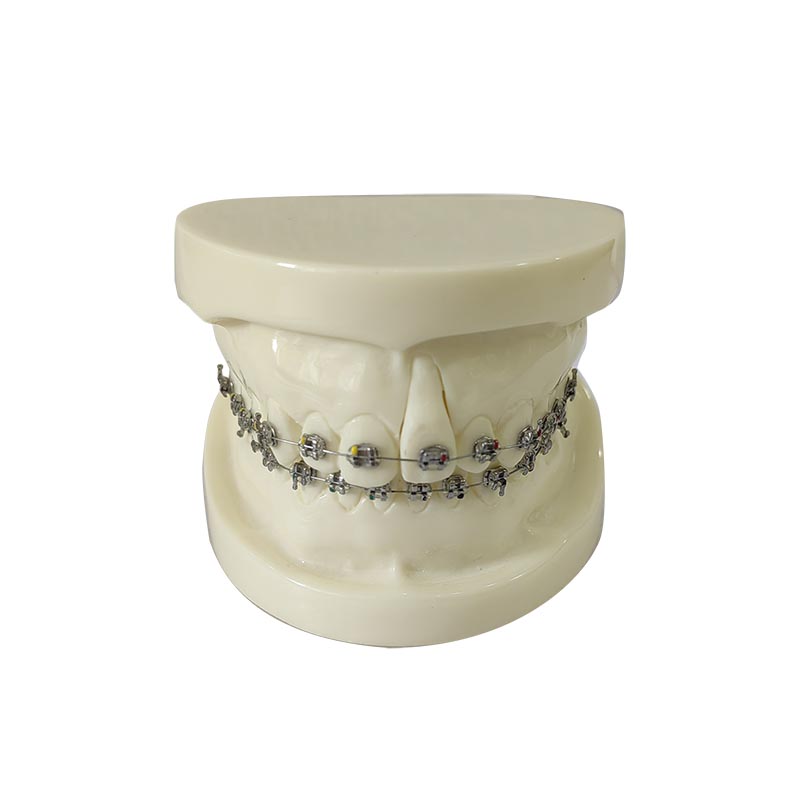 UM-HS10 Orthodontisch model voor demonstratie met Edgewise Bracket
   