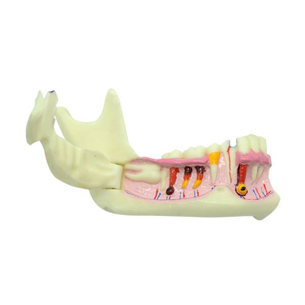 UM-F6 het Organisatie Od Mandible Model
   