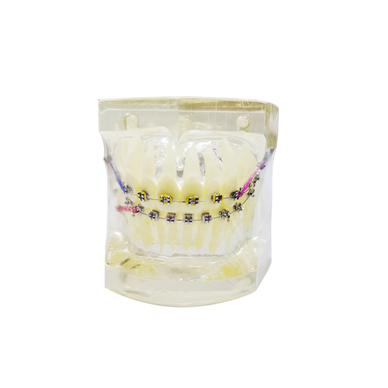 UM-S10D Orthodontic Classification Model (Transparent)