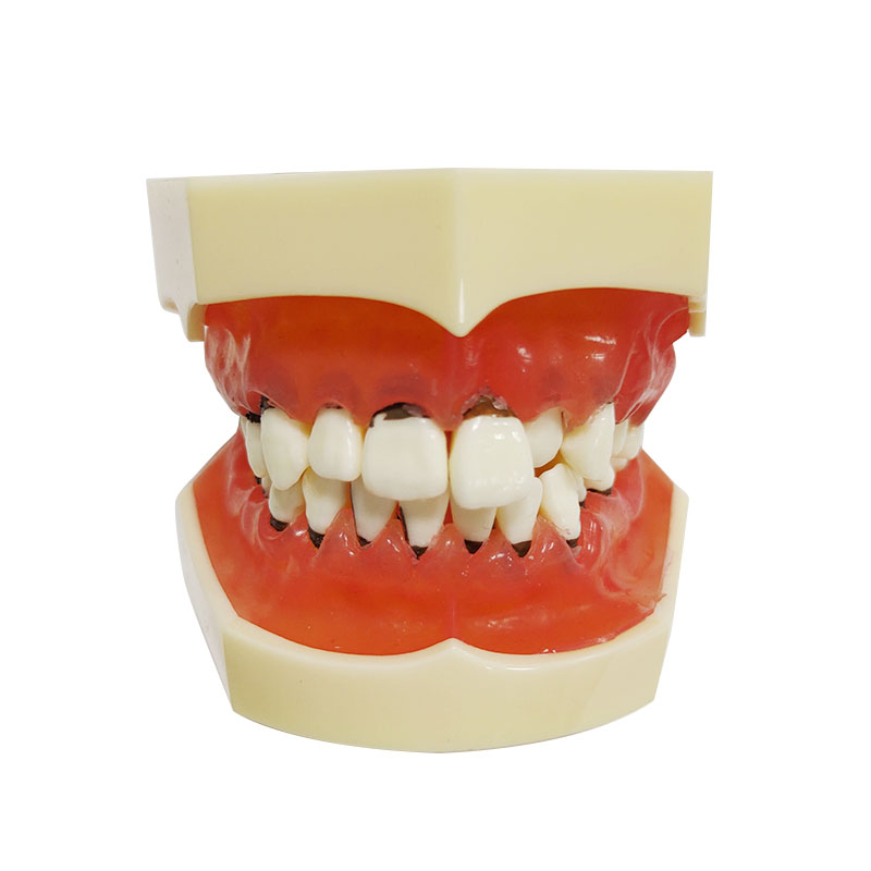 UM-4003 Periodontal Disease Model