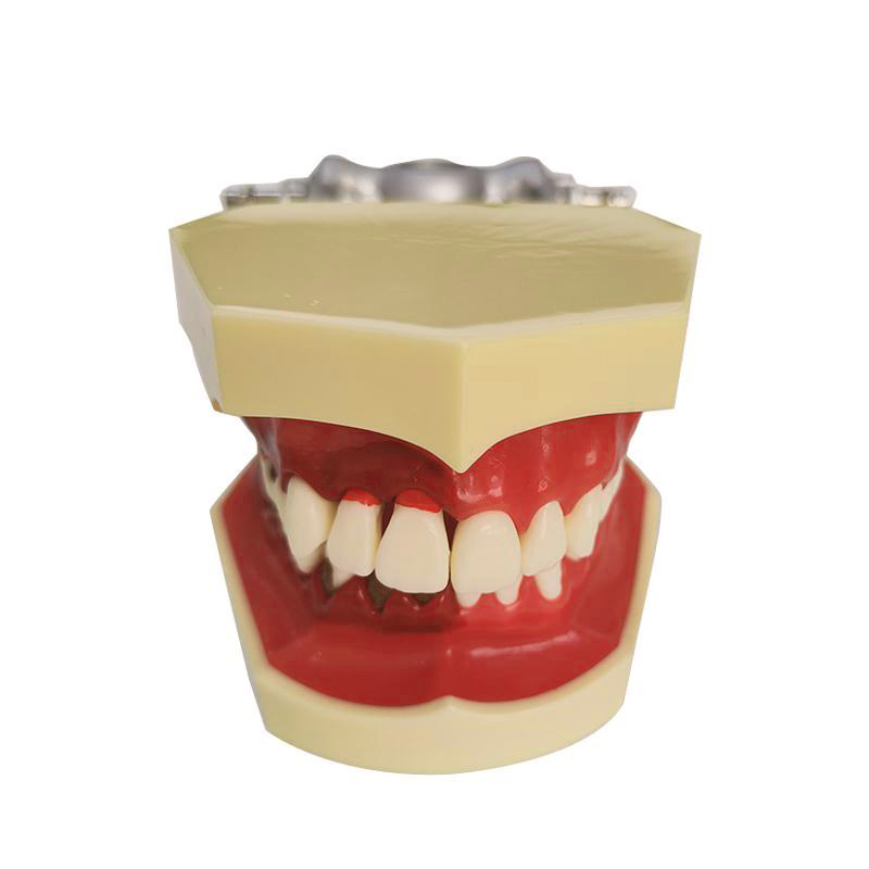 UM-4025 Periodontal Model