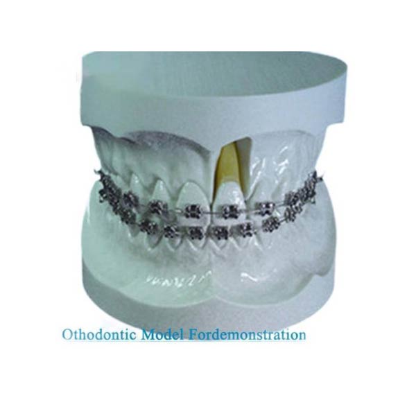 UM-S11 orthodontische model voor demonstratie met Edgewise beugel