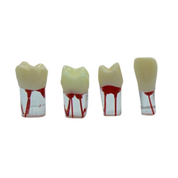 Um-ls12 Root Canal Model