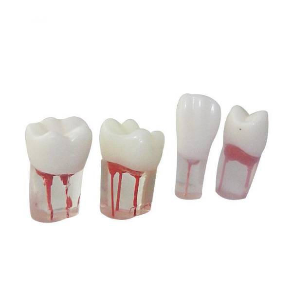 Um-ls12 Root Canal Model