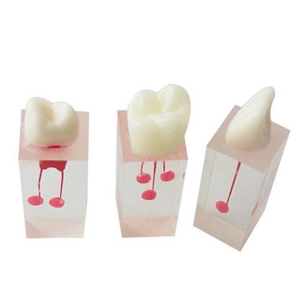 UM-LS3 Root Canal Model