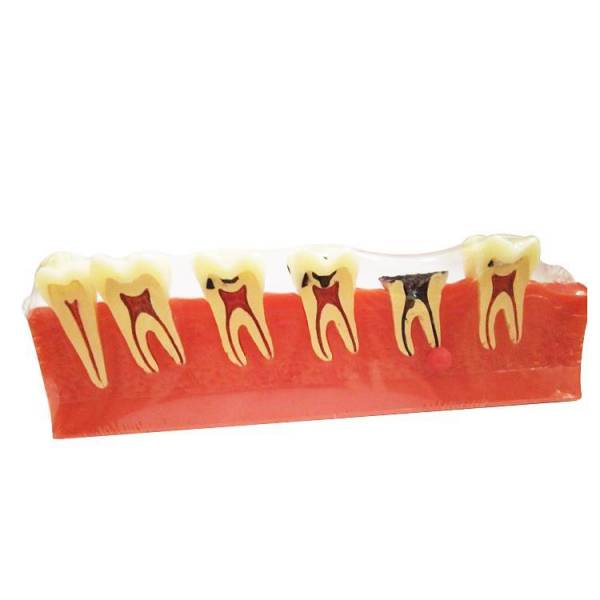 UM-E8 Periodontal Diseases Classification Model