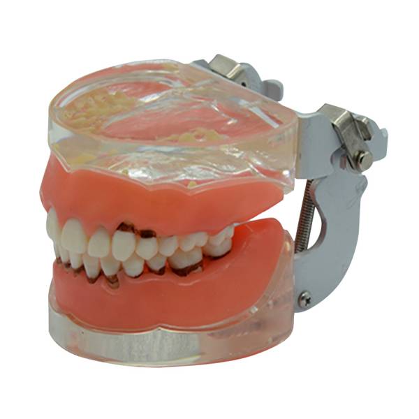 Um-s9 Gingival Disease Model