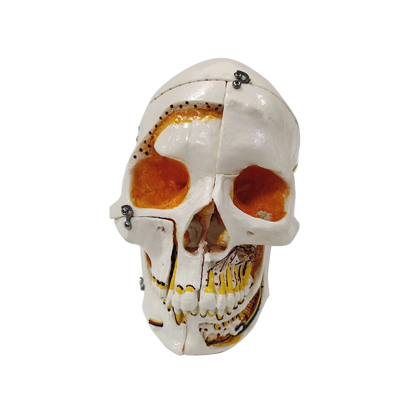 UM-F5011 menselijke schedel herstelde model (verdeeld in 10 delen)