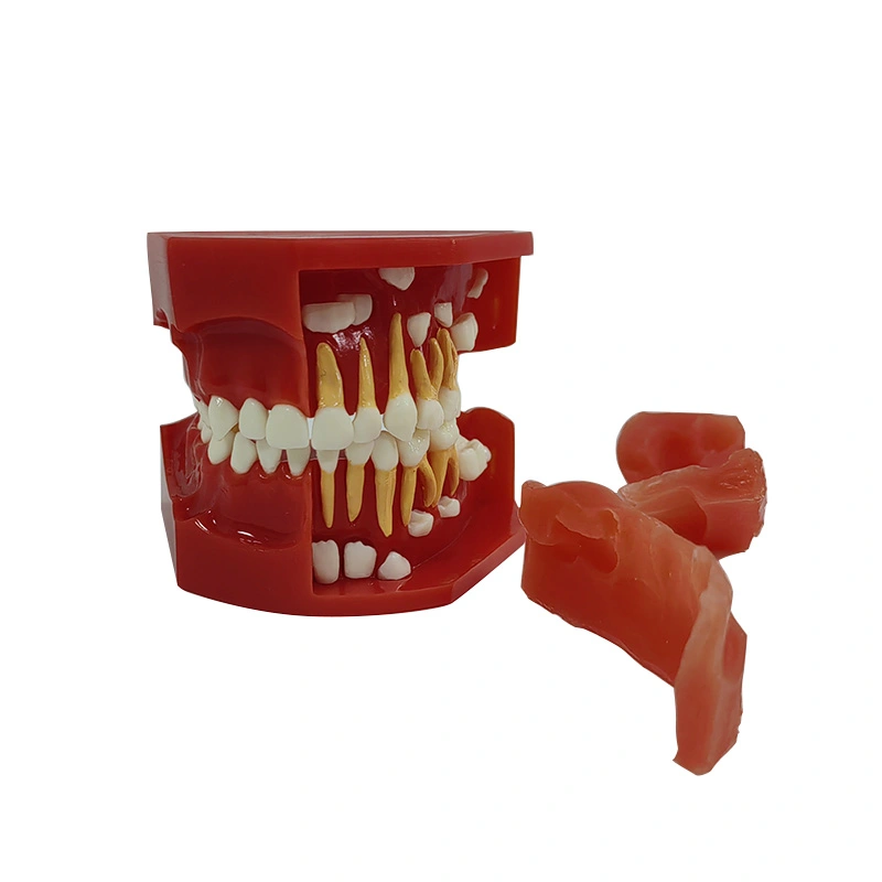 UM-S12A denturale ontwikkeling Model A (3-6 jaar oud)